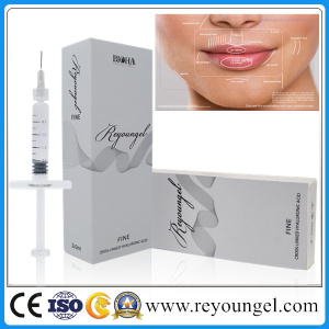 Facial Hyaluronate Acid Dermal Filler for Lip Enhancement